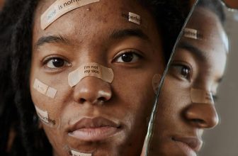 natural remedies for skincare